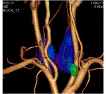 Image: The Society of Nuclear Medicine’s Image of the Year (Photo courtesy of SNM).